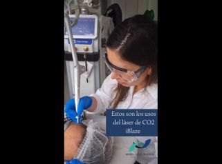 Laser CO2 - Dra. María Lucia Riveros Rueda