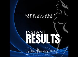 Liposucción - Dr. Alejandro Deniz Martínez