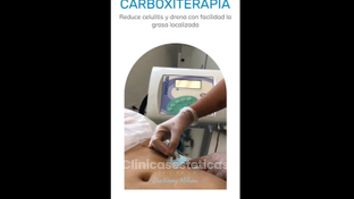 Carboxiterapia - Dra. Konny Aldana