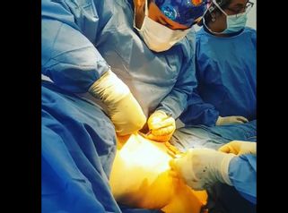 Abdominoplastia 