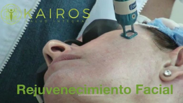 Rejuvenecimiento Facial