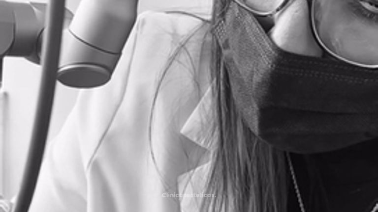 El LÁSER CO2 (2B ultrapulsado) elimina las verrugas - Dra. Yulieth Figueroa Peñaranda