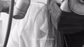 El LÁSER CO2 (2B ultrapulsado) elimina las verrugas - Dra. Yulieth Figueroa Peñaranda