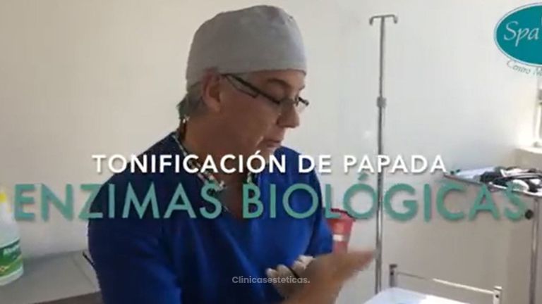 Tratamiento con Enzimas Biológicas para reducir papada