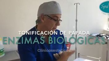 Tratamiento con Enzimas Biológicas para reducir papada