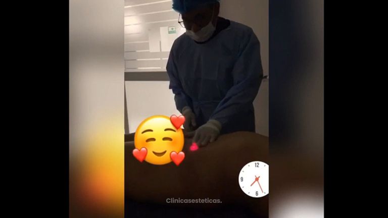 Liposucción 