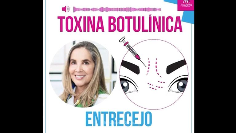 Bótox entrecejo - Doctora Alexandra Mora