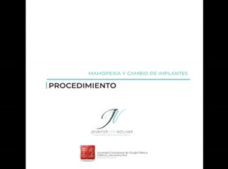 Mamopexia y cambio de implantes - Dra. Jennifer Vera Bolívar