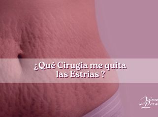 Que Cirugía me quita las estrias? - Dr. Jaime Lozada Ruiz