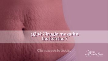 Que Cirugía me quita las estrias? - Dr. Jaime Lozada Ruiz