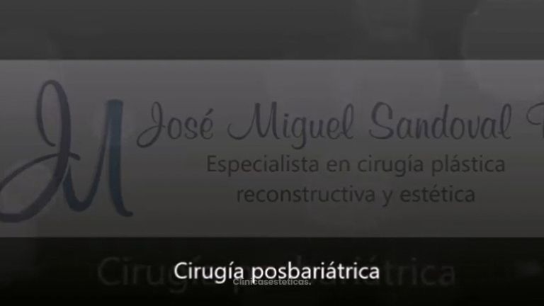 Abdominoplastia - Dr. José Miguel Sandoval Rodríguez