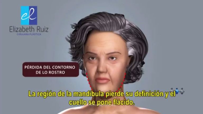 Elimina las arrugas de tu rostro