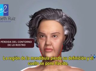 Elimina las arrugas de tu rostro