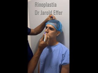 Rinoplastia - Dr. Jarold Effer Taylor