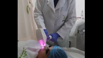 Depilación láser - Vida Bella