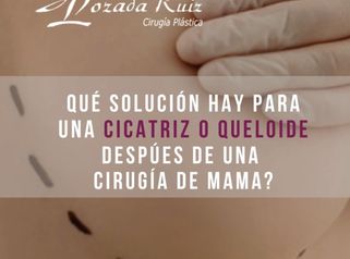 Qué Solución hay para una cicatriz o queloide después de una Cirugía de Mama?