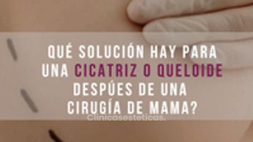 Qué Solución hay para una cicatriz o queloide después de una Cirugía de Mama?