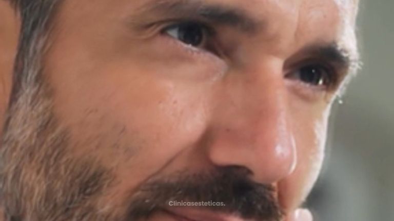 Rejuvenecimiento Facial para Hombres - Prhomex Exthetic - Dr. Oscar Calle Londoño.