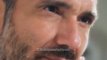 Rejuvenecimiento Facial para Hombres - Prhomex Exthetic - Dr. Oscar Calle Londoño.