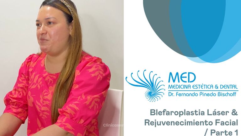 Blefaroplastia + Rejuvenecimiento Facial Parte 01 - Dr. Fernando Pinedo Bischoff