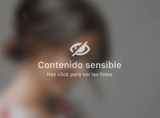 Aumento de labios - Dra. Luz María Cañavera