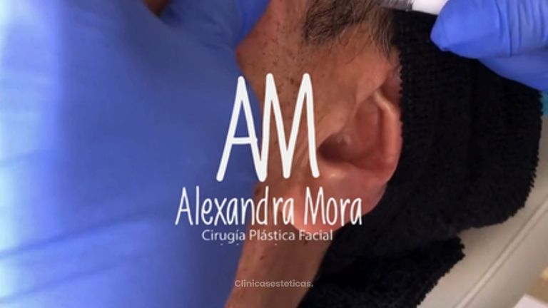Aplicación de bioestimuladores - Doctora Alexandra Mora