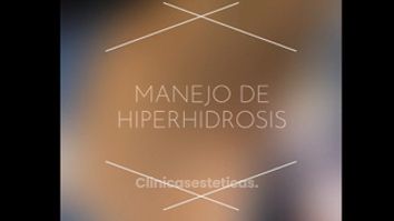 Hiperhidrosis