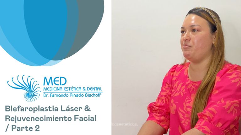 Blefaroplastia + Rejuvenecimiento Facial Parte 02 - Dr. Fernando Pinedo Bischoff