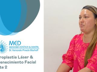 Blefaroplastia + Rejuvenecimiento Facial Parte 01 - Dr. Fernando Pinedo Bischoff