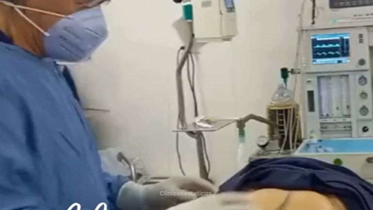 Abdominoplastia - Dr. Jaime Lozada Ruiz