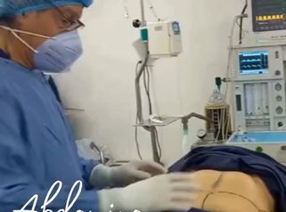 Abdominoplastia - Dr. Jaime Lozada Ruiz