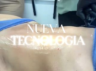 Eliminación de celulitis - Dra. Ángeles Esmeral