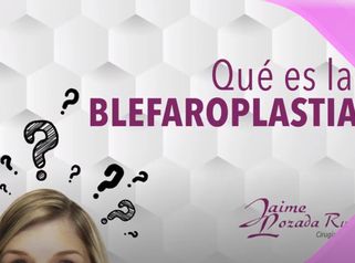 ¿Qué es Blefaroplastia?
