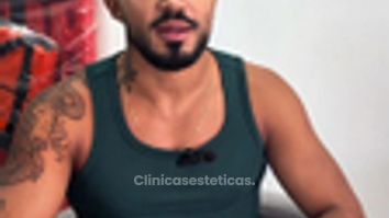 Experiencia de Paciente en Trasplante Capilar - Pilocare