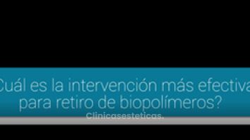 ¿Cuál es la mejor técnica para retirar los biopolímeros?