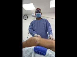 Gluteoplastia - Dr. Luis Fernando Reyes & Dra. Nicole Echeverry