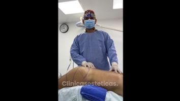 Gluteoplastia - Dr. Luis Fernando Reyes & Dra. Nicole Echeverry