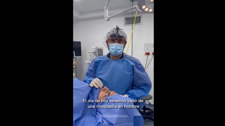Rinoplastia - Dr. Darío Jurís