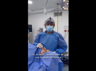 Rinoplastia - Dr. Darío Jurís