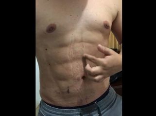 Marcación Abdominal 