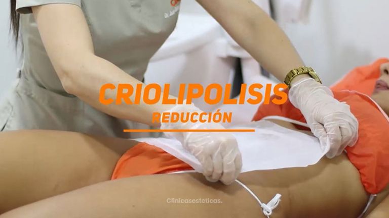 Criolipólisis - Dr. Juan Guillermo Cadena