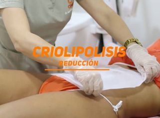 Criolipólisis - Dr. Juan Guillermo Cadena