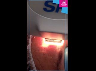 Rejuvenecimiento facial - Doctora Alexandra Mora