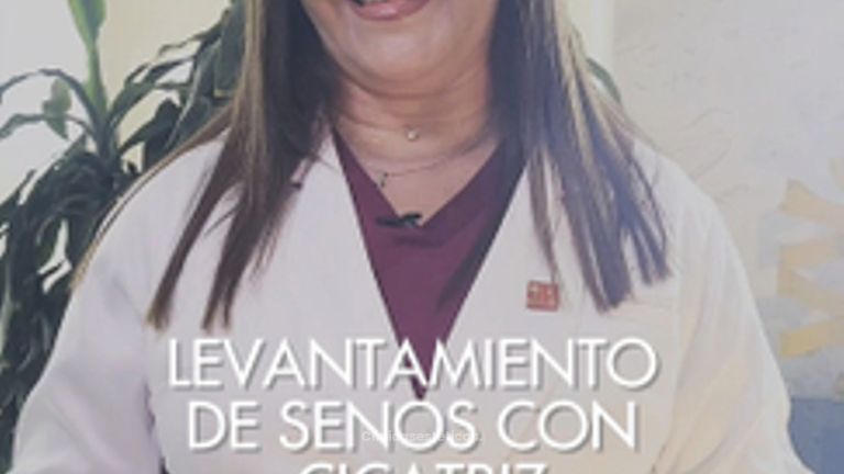 Levantamiento de Senos con cicatriz reducida - Dra. Damaris Romero