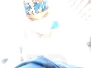 Mamoplastia de aumento - Dr. Jorge Puello White
