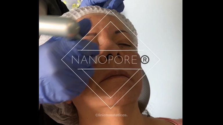 Tratamiento Nanopore