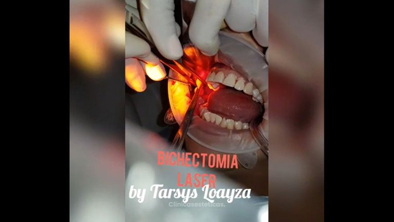 Sonrisa Perfecta Dental - Dra. Tarsys Loayza Roys