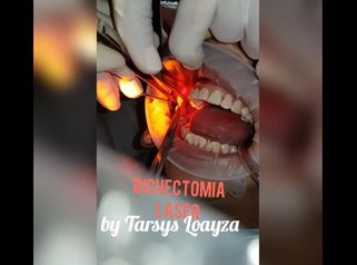 Sonrisa Perfecta Dental - Dra. Tarsys Loayza Roys
