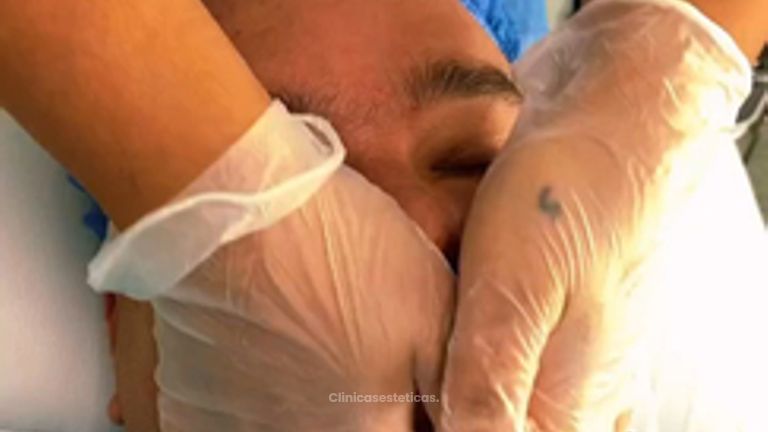 Limpieza facial - Dr. Carlos Arturo Cervantes López
