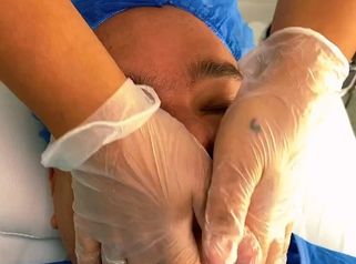 Limpieza facial - Dr. Carlos Arturo Cervantes López